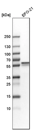 Western blot analysis in human cell line EFO-21.