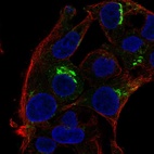 Anti-SPP1 Antibody