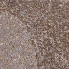 Immunohistochemical staining of human tonsil shows moderate cytoplasmic positivity in non-germinal center cells.