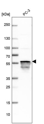 Western blot analysis in human cell line PC-3.