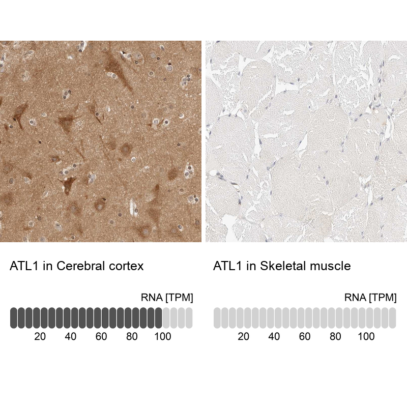 Anti-ATL1 Antibody