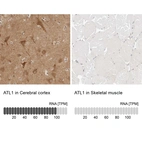 Anti-ATL1 Antibody