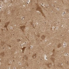 Immunohistochemical staining of human cerebral cortex shows high expression.