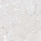 Immunohistochemical staining of human skeletal muscle shows low expression as expected.