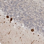 Anti-PPP2R5C Antibody