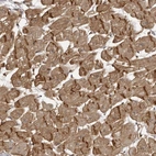 Immunohistochemical staining of human cerebral cortex using Anti-SORBS1 antibody HPA027559.