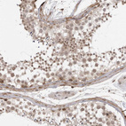 Immunohistochemical staining of human testis using Anti-SORBS1 antibody HPA027559.