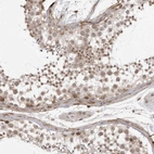 Immunohistochemical staining of human testis using Anti-SORBS1 antibody HPA027559.