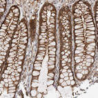 Immunohistochemical staining of human colon using Anti-SORBS1 antibody HPA027559.