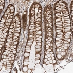 Immunohistochemical staining of human colon using Anti-SORBS1 antibody HPA027559.