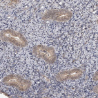 Immunohistochemical staining of human lymph node using Anti-SORBS1 antibody HPA027559.