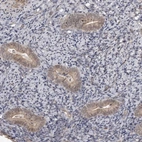 Immunohistochemical staining of human lymph node using Anti-SORBS1 antibody HPA027559.