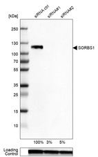 Western blot analysis in Caco-2 cells transfected with control siRNA, target specific siRNA probe #1 and #2, using Anti-SORBS1 antibody. Remaining relative intensity is presented. Loading control: Anti-GAPDH.