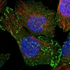 Immunofluorescent staining of human cell line U-2 OS shows localization to plasma membrane, centrosome & focal adhesion sites.