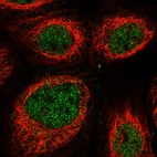 Immunofluorescent staining of human cell line A-431 shows localization to nucleoplasm.