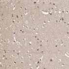 Immunohistochemical staining of human cerebral cortex shows moderate nuclear and cytoplasmic positivity in neurons and glial cells.