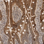 Immunohistochemical staining of human duodenum shows strong nuclear and cytoplasmic positivity in glandular cells.