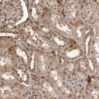 Immunohistochemical staining of human kidney shows moderate nuclear and cytoplasmic positivity in cells in tubules.