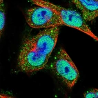 Immunofluorescent staining of human cell line U-251 MG shows localization to nucleoplasm & vesicles.