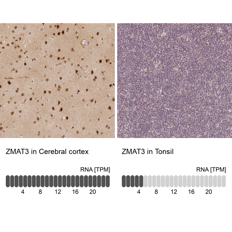 Anti-ZMAT3 Antibody