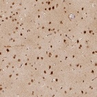 Immunohistochemical staining of human cerebral cortex shows high expression.