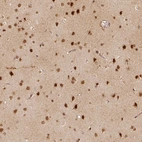 Immunohistochemical staining of human cerebral cortex shows high expression.