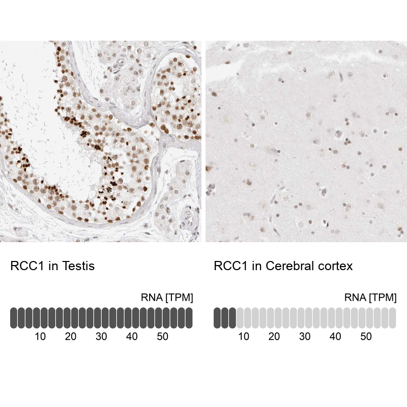 Anti-RCC1 Antibody