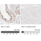 Anti-RCC1 Antibody