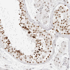 Immunohistochemical staining of human testis shows strong nuclear positivity in cells in seminiferous ducts.