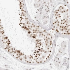 Immunohistochemical staining of human testis shows strong nuclear positivity in cells in seminiferous ducts.