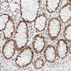Immunohistochemical staining of human rectum shows strong nuclear positivity in glandular cells.
