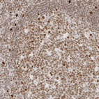 Immunohistochemical staining of human tonsil shows strong nuclear positivity in germinal and non-germinal center cells.