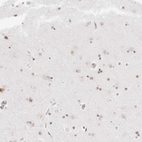 Immunohistochemical staining of human cerebral cortex shows very weak nuclear positivity in neurons.