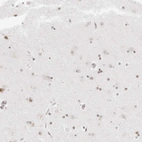 Immunohistochemical staining of human cerebral cortex shows very weak nuclear positivity in neurons.