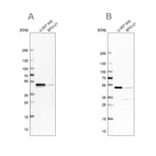 Western blot analysis using Anti-RCC1 antibody HPA027573 (A) shows similar pattern to independent antibody HPA027574 (B).