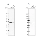 Western blot analysis using Anti-RCC1 antibody HPA027573 (A) shows similar pattern to independent antibody HPA027574 (B).