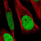 Immunofluorescent staining of human cell line U-2 OS shows localization to nucleoplasm.