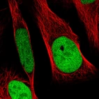 Immunofluorescent staining of human cell line U-2 OS shows localization to nucleoplasm.