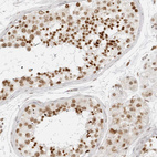 Anti-RCC1 Antibody