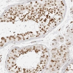 Anti-RCC1 Antibody