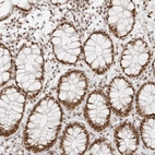 Immunohistochemical staining of human rectum shows strong nuclear positivity in glandular cells.