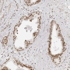 Immunohistochemical staining of human prostate shows moderate nuclear positivity in glandular cells.