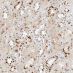 Immunohistochemical staining of human kidney shows moderate nuclear positivity in cells in tubules.