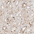 Immunohistochemical staining of human kidney shows moderate nuclear positivity in cells in tubules.