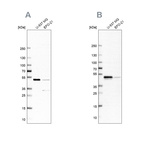 Western blot analysis using Anti-RCC1 antibody HPA027574 (A) shows similar pattern to independent antibody HPA027573 (B).