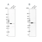 Western blot analysis using Anti-RCC1 antibody HPA027574 (A) shows similar pattern to independent antibody HPA027573 (B).