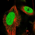 Immunofluorescent staining of human cell line U-251 MG shows localization to nucleoplasm & nuclear membrane.