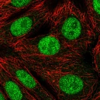 Immunofluorescent staining of human cell line MCF7 shows localization to nucleoplasm.