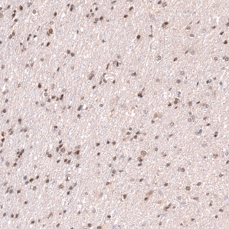 Anti-RNF220 Antibody