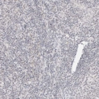 Immunohistochemical staining of human tonsil shows low expression as expected.